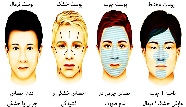 تشخیص انواع پوست